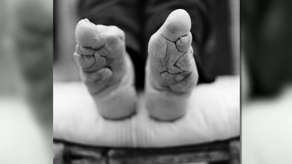 Foot Binding, entrevisttas.com